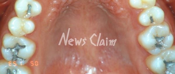 정창원씨 치아 및 잇몸 사진. 정씨 제공