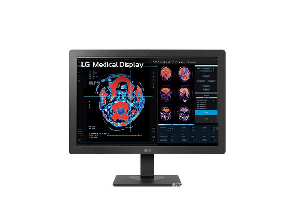 LG전자의 의료용 모니터는 높아진 휘도로 임상용과 진단용으로 모두 활용 가능하다. LG전자 제공