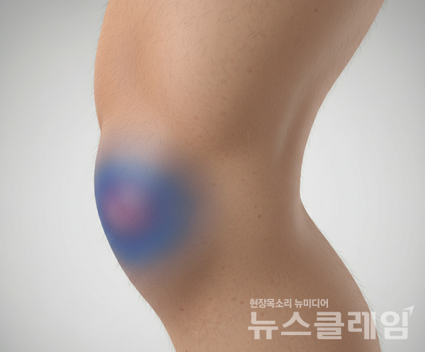 일상에서 흔히 접하는 표현 중 하나인 '푸르딩딩'과 '푸르뎅뎅' 중 올바른 표현은 '푸르뎅뎅'이다. 뉴스클레임DB